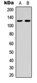 Anti-ST5 antibody used in Western Blot (WB). GTX55282