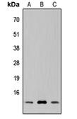 Anti-SUPT4H1 antibody used in Western Blot (WB). GTX55283