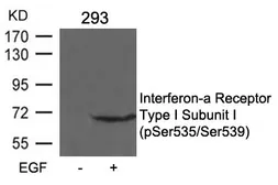 Anti-IFNAR1 (phospho Ser535/Ser539) antibody used in Western Blot (WB). GTX55295