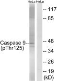 Anti-Caspase 9 (phospho Thr125) antibody used in Western Blot (WB). GTX55305