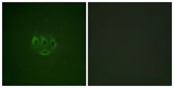 Anti-ACK1 (phospho Tyr284) antibody used in Immunocytochemistry/ Immunofluorescence (ICC/IF). GTX55310