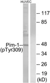 Anti-PIM1 (phospho Tyr309) antibody used in Western Blot (WB). GTX55311