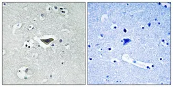 Anti-RASGRF1 (phospho Ser916) antibody used in IHC (Paraffin sections) (IHC-P). GTX55312