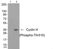 Anti-Cyclin H (phospho Thr315) antibody used in Western Blot (WB). GTX55316