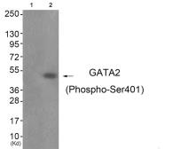 Anti-GATA2 (phospho Ser401) antibody used in Western Blot (WB). GTX55317