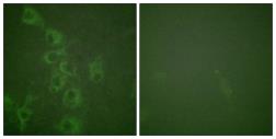 Anti-HRH1 (phospho Ser398) antibody used in Immunocytochemistry/ Immunofluorescence (ICC/IF). GTX55318