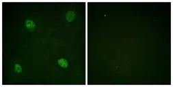 Anti-AUF1 (phospho Ser83) antibody used in Immunocytochemistry/ Immunofluorescence (ICC/IF). GTX55319