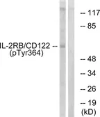 Anti-IL2 Receptor beta (phospho Tyr364) antibody used in Western Blot (WB). GTX55320