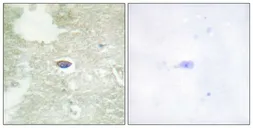 Anti-TGF beta Receptor 2 (phospho Ser225/250) antibody used in IHC (Paraffin sections) (IHC-P). GTX55322