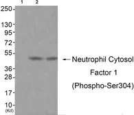 Anti-NCF1 (phospho Ser304) antibody used in Western Blot (WB). GTX55323