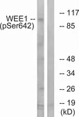 Anti-WEE1 (phospho Ser642) antibody used in Western Blot (WB). GTX55324