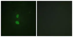 Anti-SNAI1 (phospho Ser246) antibody used in Immunocytochemistry/ Immunofluorescence (ICC/IF). GTX55326