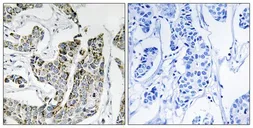 Anti-BLK (phospho Tyr501) antibody used in IHC (Paraffin sections) (IHC-P). GTX55328