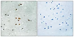 Anti-FER (phospho Tyr402) antibody used in IHC (Paraffin sections) (IHC-P). GTX55330