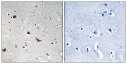 Anti-IKK gamma (phospho Ser376) antibody used in IHC (Paraffin sections) (IHC-P). GTX55331