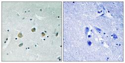 Anti-MAP3K8 (phospho Ser400) antibody used in IHC (Paraffin sections) (IHC-P). GTX55334