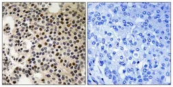 Anti-PAK2 (phospho Ser197) antibody used in IHC (Paraffin sections) (IHC-P). GTX55335