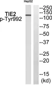 Anti-TIE2 (phospho Tyr992) antibody used in Western Blot (WB). GTX55336