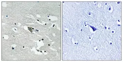 Anti-VEGF Receptor 1 (phospho Tyr1048) antibody used in IHC (Paraffin sections) (IHC-P). GTX55337