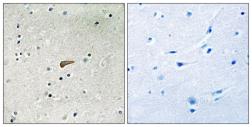 Anti-FRS2 (phospho Tyr436) antibody used in IHC (Paraffin sections) (IHC-P). GTX55340