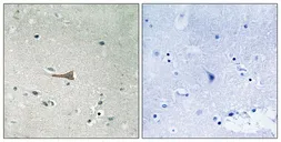 Anti-DDR1 (phospho Tyr513) antibody used in IHC (Paraffin sections) (IHC-P). GTX55341