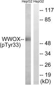 Anti-WWOX (phospho Tyr33) antibody used in Western Blot (WB). GTX55345