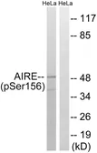 Anti-AIRE (phospho Ser156) antibody used in Western Blot (WB). GTX55346