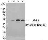 Anti-RUNX1 (phospho Ser435) antibody used in Western Blot (WB). GTX55347