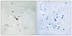 Anti-APLP2 (phospho Tyr755) antibody used in IHC (Paraffin sections) (IHC-P). GTX55348