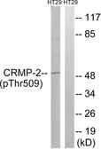 Anti-CRMP2 (phospho Thr509) antibody used in Western Blot (WB). GTX55355