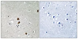 Anti-CtBP1 (phospho Ser422) antibody used in IHC (Paraffin sections) (IHC-P). GTX55356