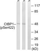 Anti-CtBP1 (phospho Ser422) antibody used in Western Blot (WB). GTX55356