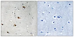 Anti-TCF3 / E2A (phospho Thr355) antibody used in IHC (Paraffin sections) (IHC-P). GTX55358