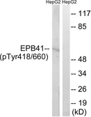 Anti-EPB41 (phospho Tyr660/418) antibody used in Western Blot (WB). GTX55359