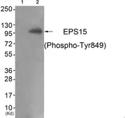 Anti-Eps15 (phospho Tyr849) antibody used in Western Blot (WB). GTX55360