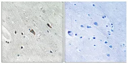 Anti-GAB2 (phospho Tyr643) antibody used in IHC (Paraffin sections) (IHC-P). GTX55361