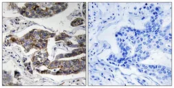 Anti-Girdin (phospho Ser1417) antibody used in IHC (Paraffin sections) (IHC-P). GTX55363