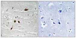 Anti-MDC1 (phospho Ser513) antibody used in IHC (Paraffin sections) (IHC-P). GTX55364