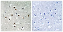 Anti-MEF2C (phospho Ser396) antibody used in IHC (Paraffin sections) (IHC-P). GTX55365