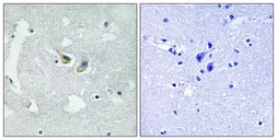 Anti-NCF1 (phospho Ser345) antibody used in IHC (Paraffin sections) (IHC-P). GTX55367