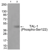 Anti-TAL1 (phospho Ser122) antibody used in Western Blot (WB). GTX55369