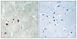 Anti-TIP60 (phospho Ser90) antibody used in IHC (Paraffin sections) (IHC-P). GTX55370