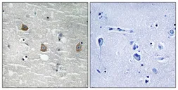 Anti-TOB1 (phospho Ser164) antibody used in IHC (Paraffin sections) (IHC-P). GTX55371