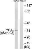 Anti-YB1 (phospho Ser102) antibody used in Western Blot (WB). GTX55373