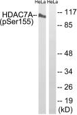 Anti-HDAC7 (phospho Ser155) antibody used in Western Blot (WB). GTX55375