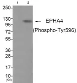Anti-EphA4 (phospho Tyr596) antibody used in Western Blot (WB). GTX55376