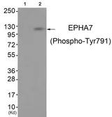 Anti-EphA7 (phospho Tyr791) antibody used in Western Blot (WB). GTX55377