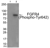 Anti-FGFR4 (phospho Tyr642) antibody used in Western Blot (WB). GTX55378