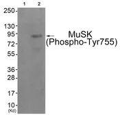 Anti-MUSK (phospho Tyr755) antibody used in Western Blot (WB). GTX55379