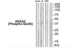 Anti-Annexin II (phospho Ser26) antibody used in Western Blot (WB). GTX55380